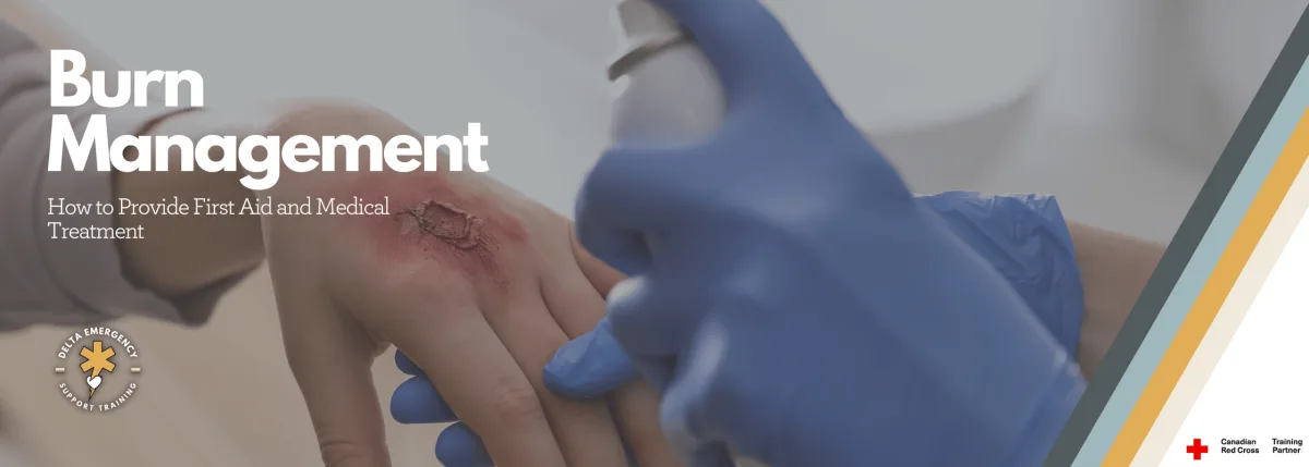 Person using antiseptic spray to clean and sanitize a burn on their hand.